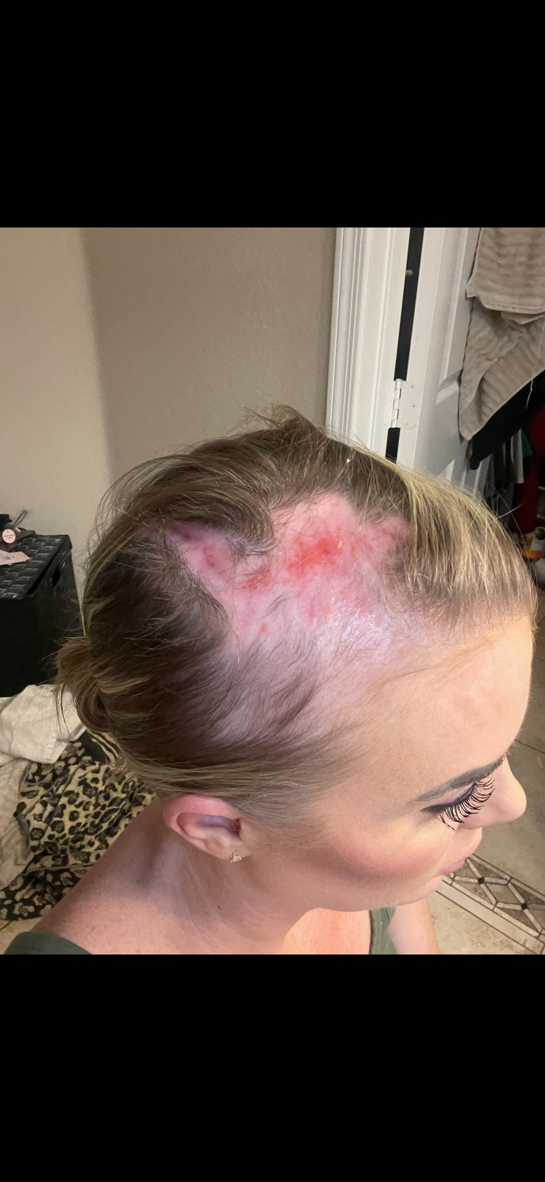 Tanya's Strength Story
