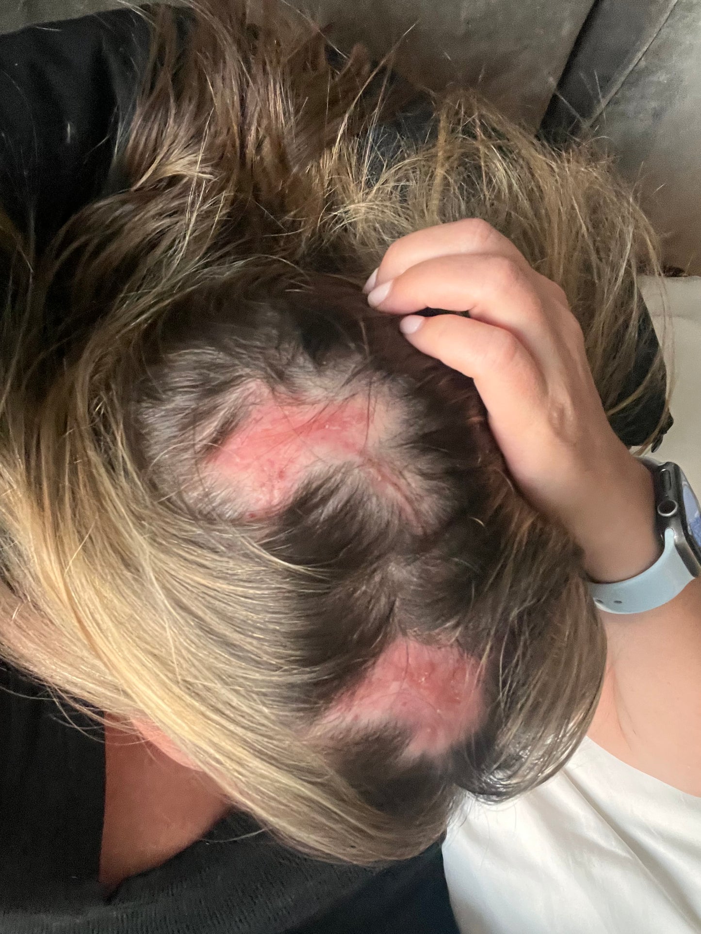 SUNIFUL™ Mineral SPF Scalp Protectant