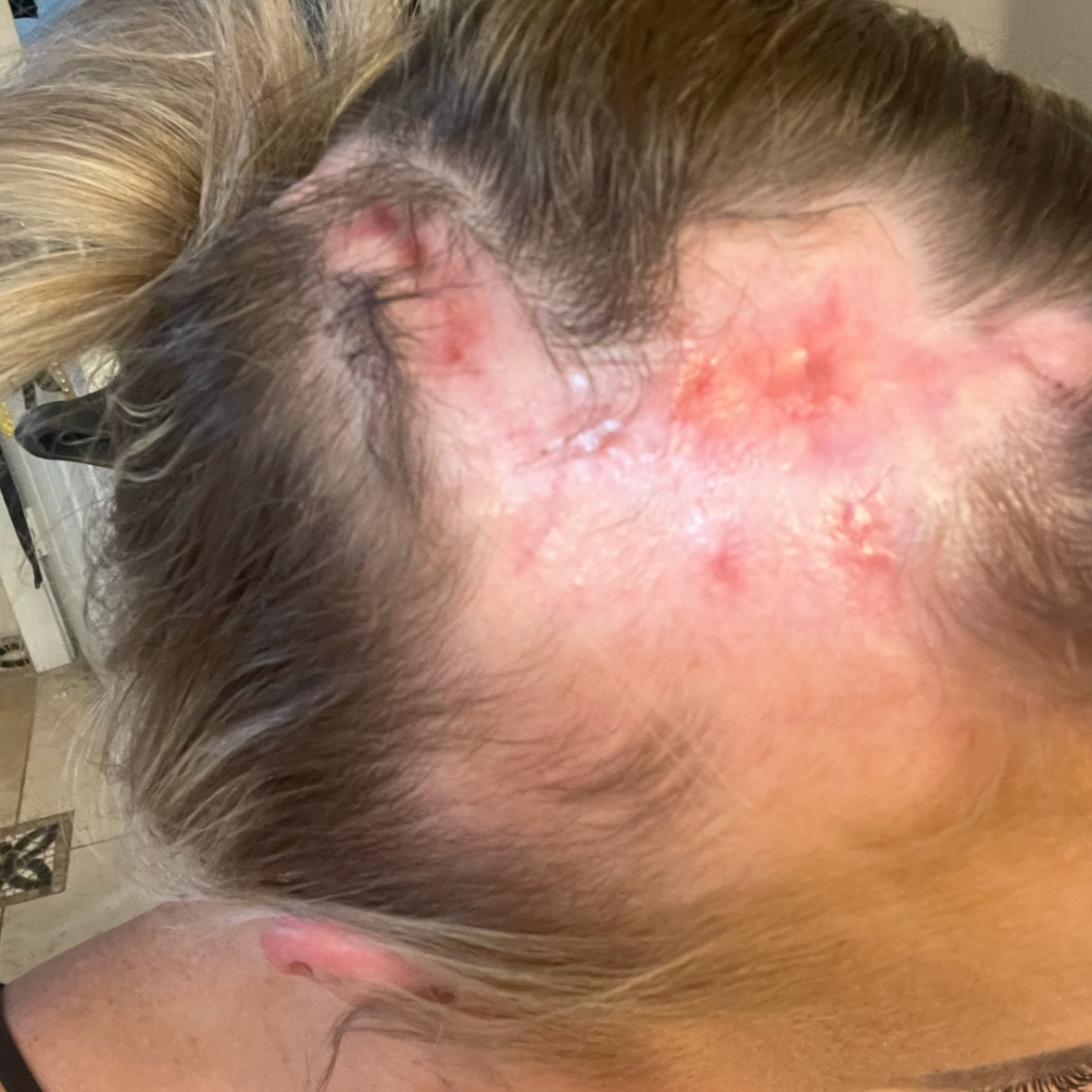 SUNIFUL™ Mineral SPF Scalp Protectant